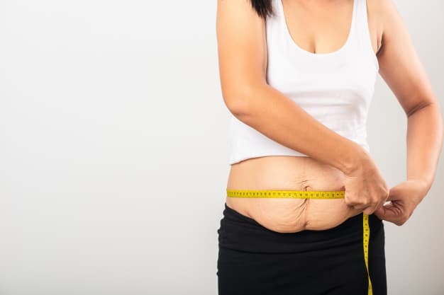 Mengenal Diastasis Recti, Kondisi Perut Kendur Usai Melahirkan