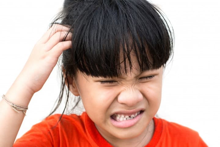 Cara Mengatasi Tinea Capitis, Infeksi pada Kulit Kepala Anak