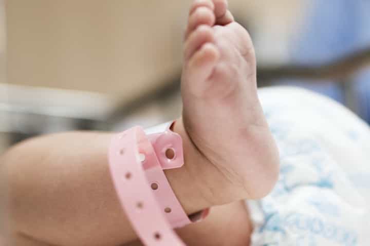 Waspada Bayi Kena Sindrom Potter Akibat Kurang Air Ketuban