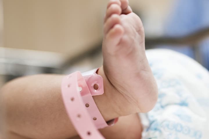 Waspada Bayi Kena Sindrom Potter Akibat Kurang Air Ketuban