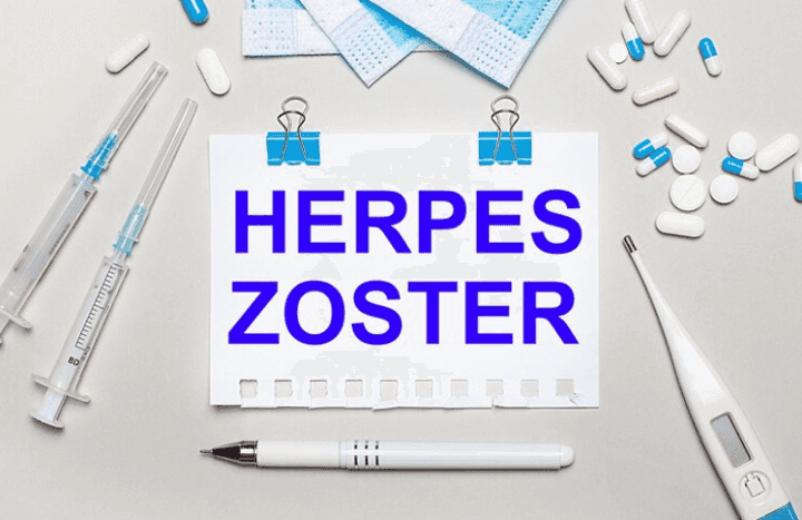 Menurut Dokter Kulit, Ini 7 Fakta Unik Seputar Cacar Ular atau Herpes Zoster