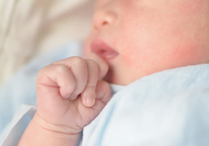 7 Penyebab Pipi Bayi Alami Kemerahan dan Menjadi Kasar