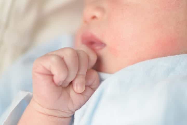 Ruam Susu pada Bayi, Benarkah Disebabkan oleh ASI?